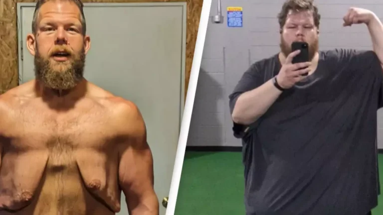 Man who lost 400 pounds is trying to raise $100K to remove excess skin