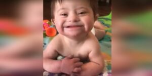 Adopted baby with Down syndrome goes viral after smiling for mom – 24/7