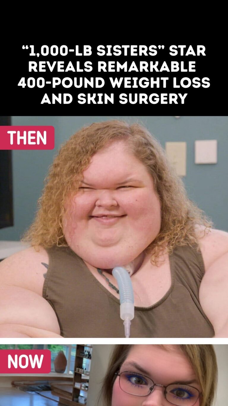 “1,000-lb Sisters” Star Reveals Remarkable 400-Pound Weight Loss and Skin Surgery