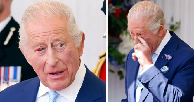 New picture of King Charles raises concerns about his health