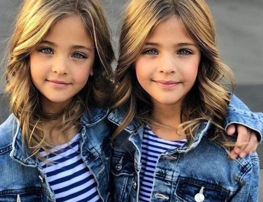 12 Years Ago They Were Called The World’s Most Beautiful Twins – Now Look At Them