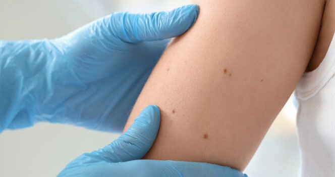 18-year-old didn’t know his symptoms were cancer until it was too late